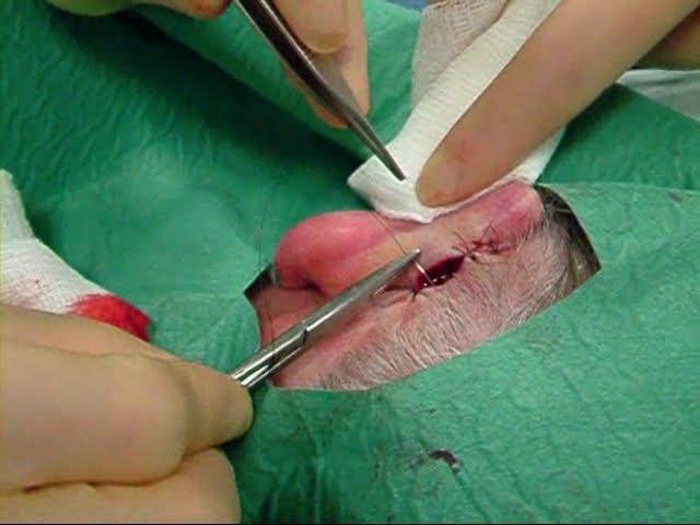 Skin surgery - mattress suturing