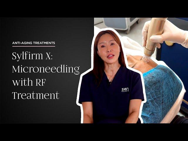 RF Microneedling | Anti-Aging Aesthetic Treatments