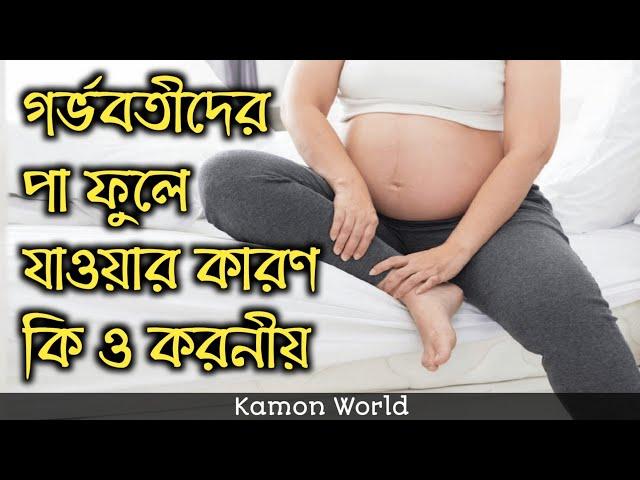 গর্ভবতীদের পা ফুলে যাওয়ার কারণ কি ও করনীয় | gorvobotir pa fule gele koronio.