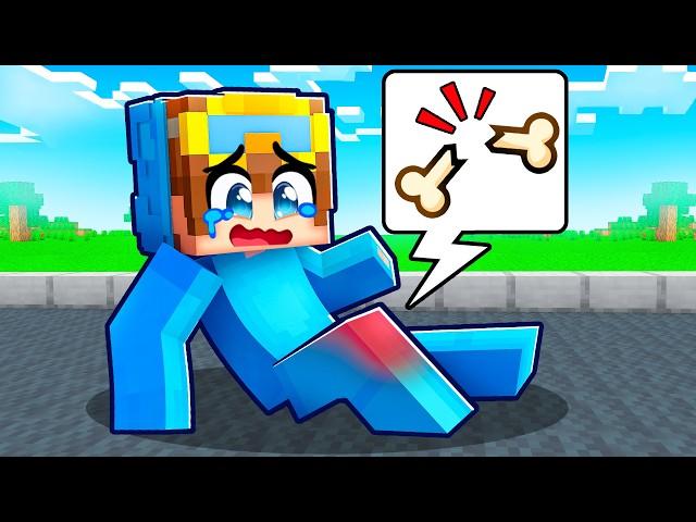 Nico BROKE HIS LEG In Minecraft!