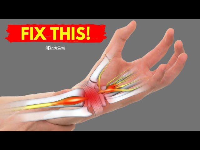 How to Fix Wrist Pain for Good