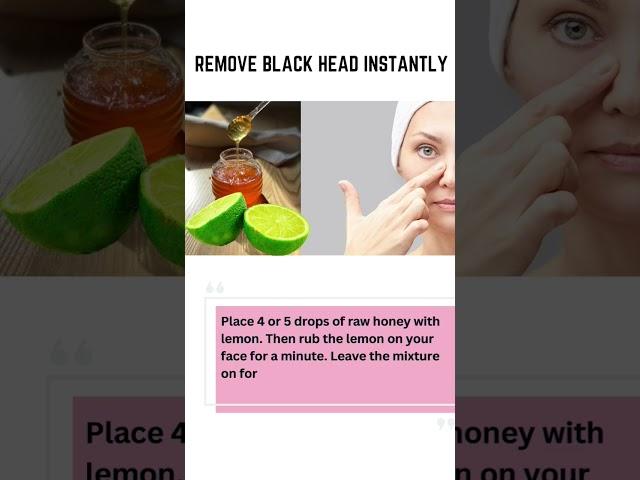 BLACKHEADS REMOVAL #beautysecret #beautytips #beautycare#beautyproducts #beautyaddicts #beautytime 