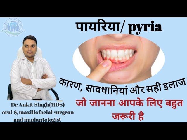 पायरिया क्या है?what is Pyria,Cause,Symptoms|pyria tretament