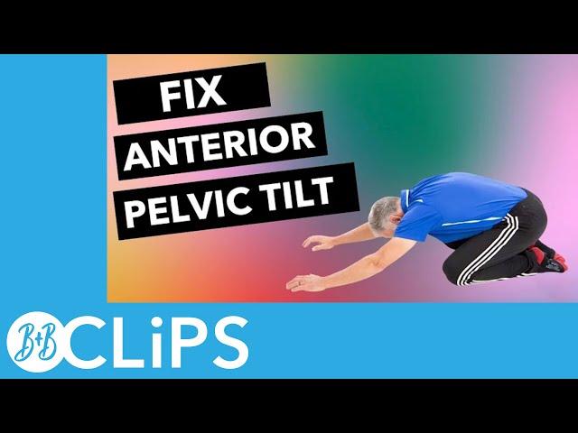 Fix Anterior Pelvic Tilt (4 Critical Exercises) (B&B Clips)