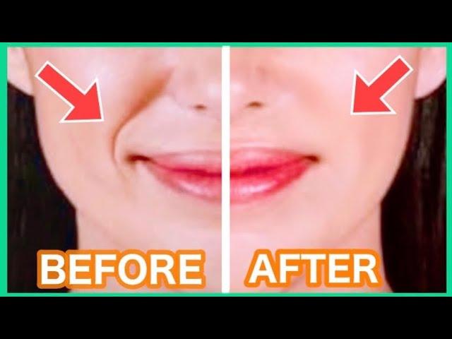 Get Rid Of Smile Lines with This Massage️! (Nasolabial Folds/ Laugh Lines)