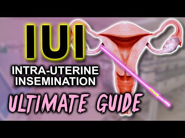 IUI - Fertility expert secrets for maximum pregnancy rates