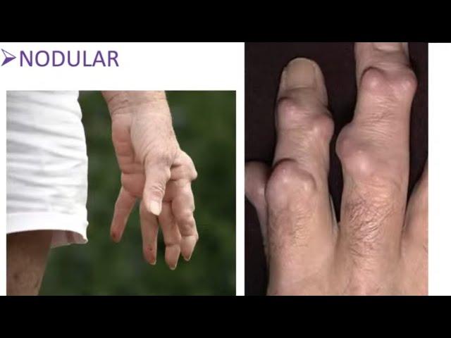 Rheumatoid Hand and Wrist for the FRCSOrth