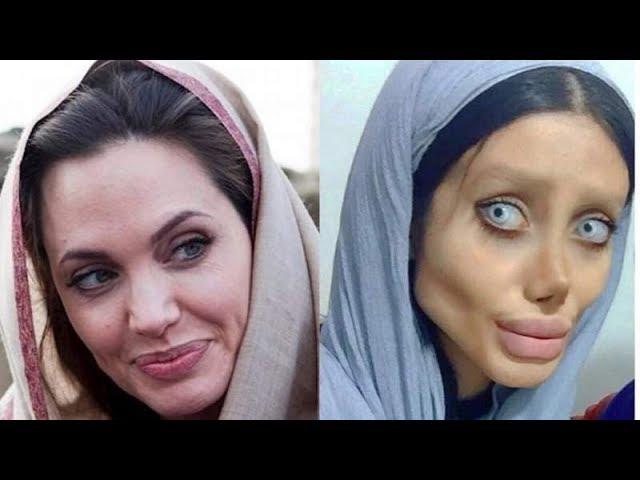 The 15 most unsuccessful plastic surgery celebrities