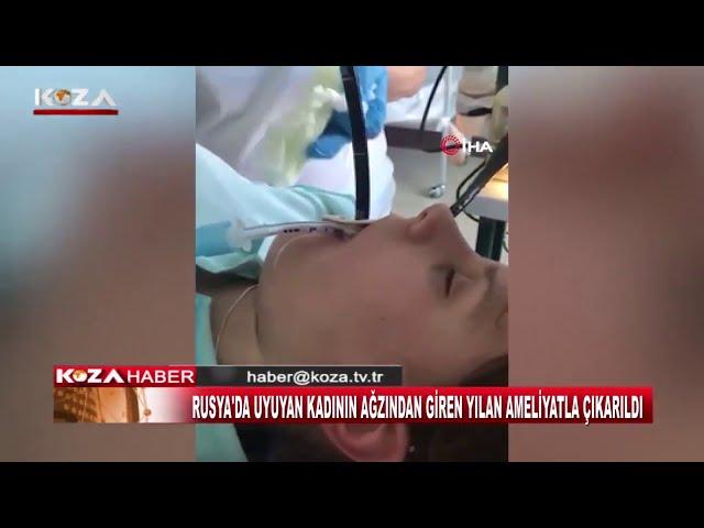 UYUYAN KADININ AĞZINDAN GİREN YILAN AMELİYATLA ÇIKARILDI