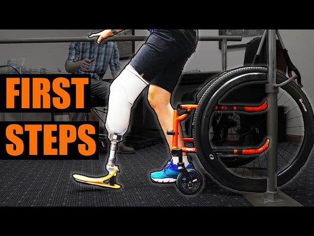 Amputee's First Steps on a Prosthetic Leg