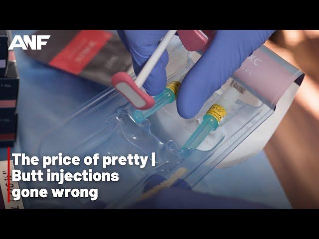 The price of pretty: Butt injections gone wrong