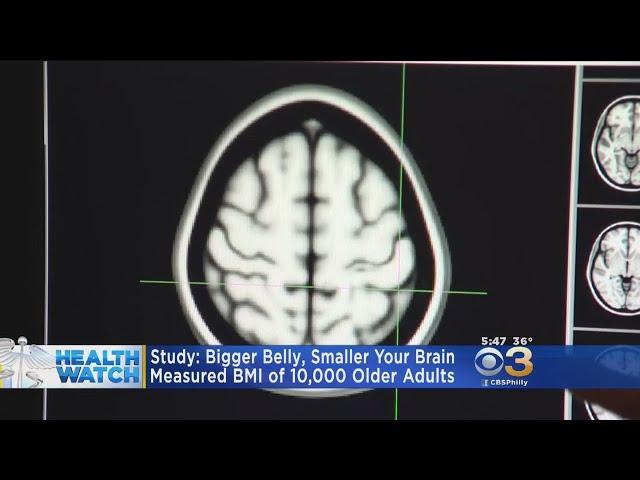 Study: Bigger Belly, Smaller Your Brain