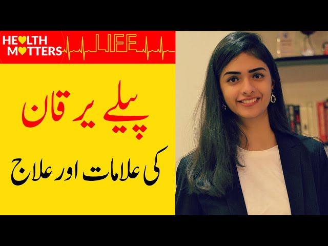 Jaundice Kyu Hota Hai | Pele Yarkan Ka Asan Ilaj In Urdu/Hindi | Zoha Sohail