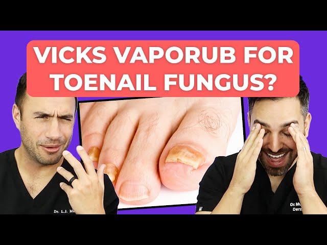 Ointment To CURE Toenail Fungus? | Doctorly Investigates