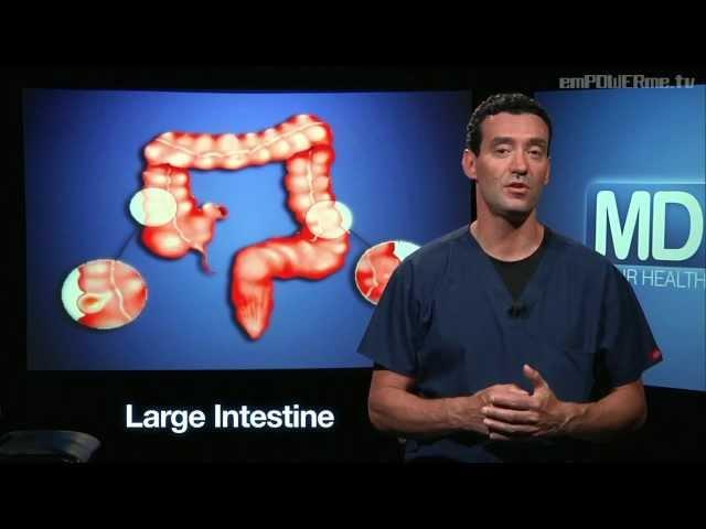 Colon Cancer with Dr. Howard Schecter : MD-VOD