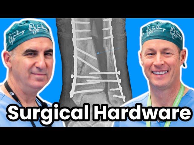 Should I Have My Plate And Screws Removed?  Hardware Removal Surgery