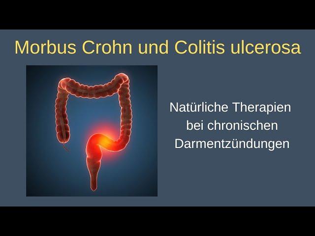 Morbus Crohn und Colitis ulcerosa - Alexander Glogg im Gespräch mit Dr. Volker Schmiedel