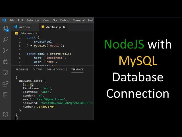 MySQL Database connection from node js application