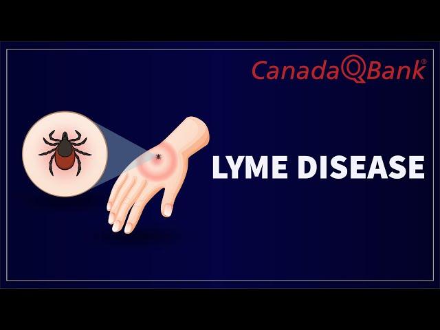 Lyme Disease