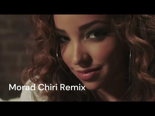 Tinashe -  Vulnerable - (Morad Chiri Remix) Official Video)
