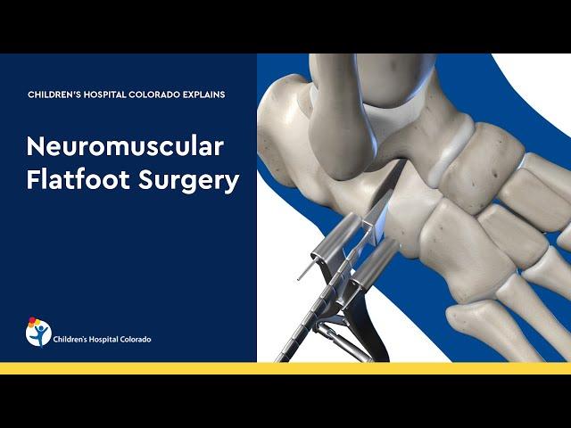 Neuromuscular Flatfoot Surgery