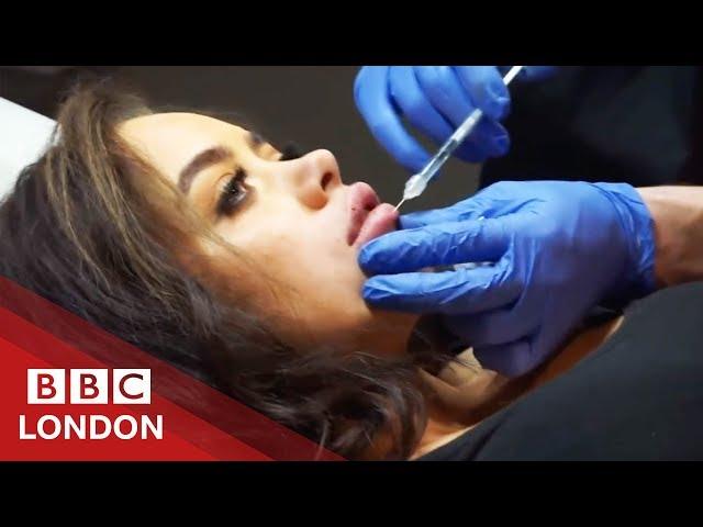 Plastic surgery gone wrong: 'My lip was about to fall off' - BBC London