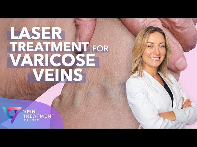 Medical Center: Laser Treatment for Varicose Veins | Spider and Varicose Vein Treatment Center