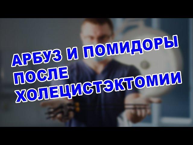 ЖИЗНЬ ПОСЛЕ УДАЛЕНИЯ ЖЕЛЧНОГО ПУЗЫРЯ: АРБУЗ, ПОМИДОРЫ, КОЛОНОСКОПИЯ