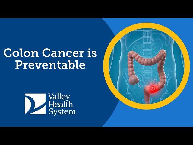 Colon Cancer is Preventable