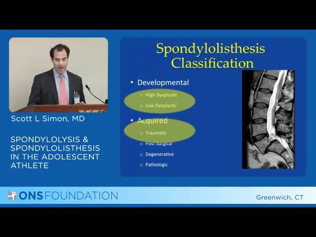 Spondylolysis & Spondylolisthesis in the Adolescent Athlete