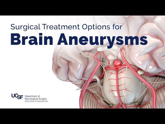 Surgical Treatment Options for Brain Aneurysms