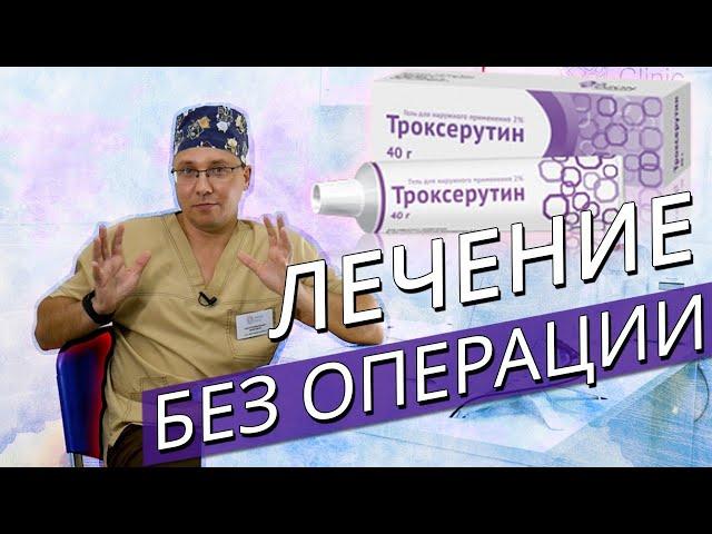 Лечение Варикоза без операции. Детралекс. Троксевазин. Троксерутин.