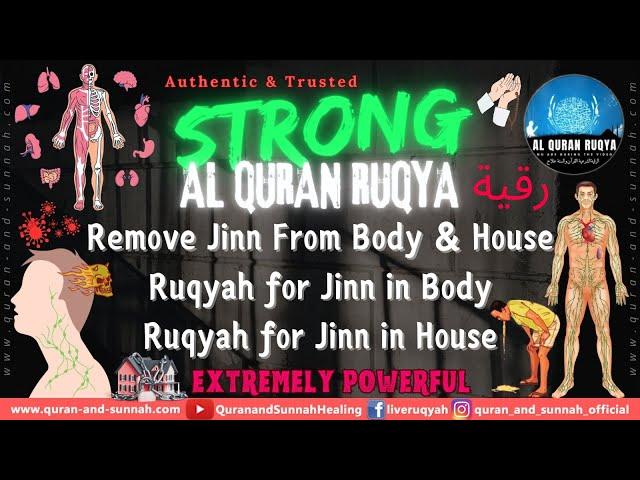 Quran Ruqyah to Remove Jinn From Body and House - Ruqyah for Jinn in Body - Ruqyah for Jinn in House