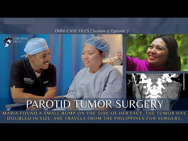 Nursing Student Develops Tumor in Parotid Gland