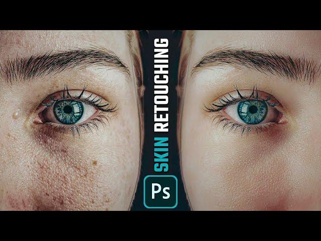 Clean Your Skin - Skin Retouching | Best Photoshop Tutorial