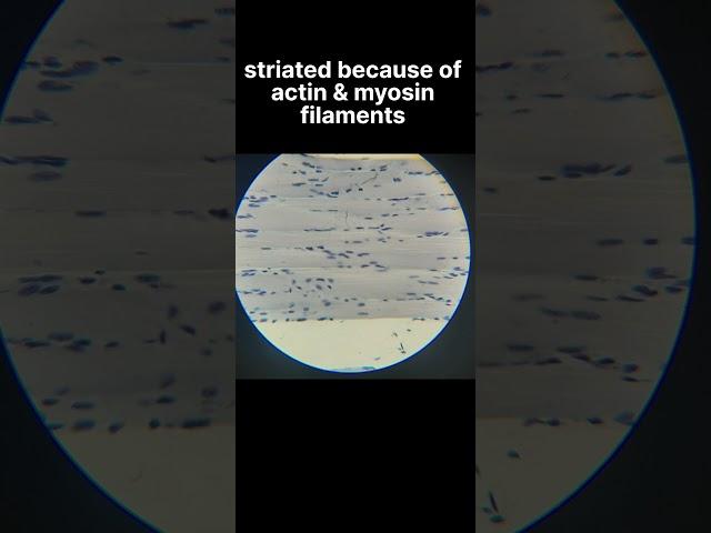 How to identify Skeletal muscles histology slide #learnanatomywithfun #anatomy