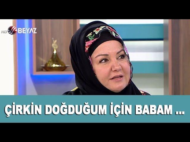 Çirkin doğduğum için babam beni sevmedi! İkbal Gürpınar duygulandırdı...