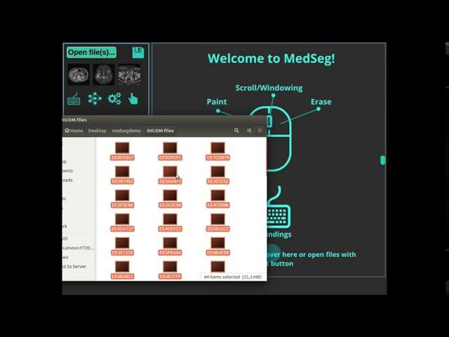 Converting DICOM to nifti in the web-browser