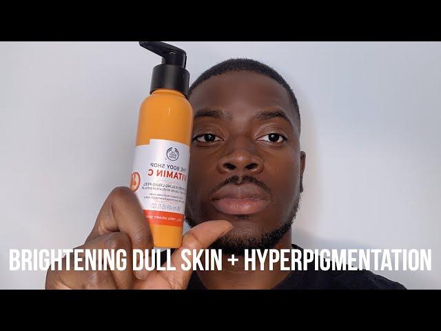 HOW I GOT RID OF DARK SPOTS, BRIGHTEN DULL SKIN + HYPERPIGMENTATION