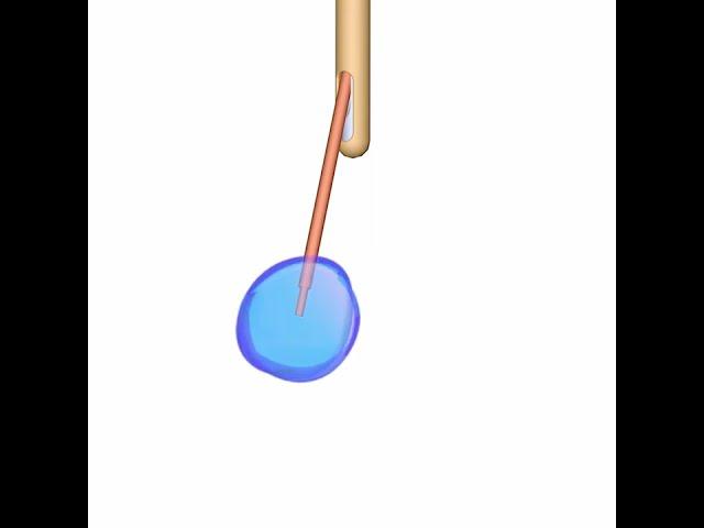 Radially Branching Cellular Delivery Device for Use in OR Fluoroscopy/CT Guidance & MRI