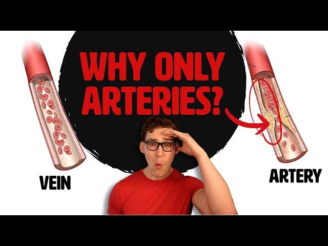 Why do we develop plaque in our arteries, but not our veins?