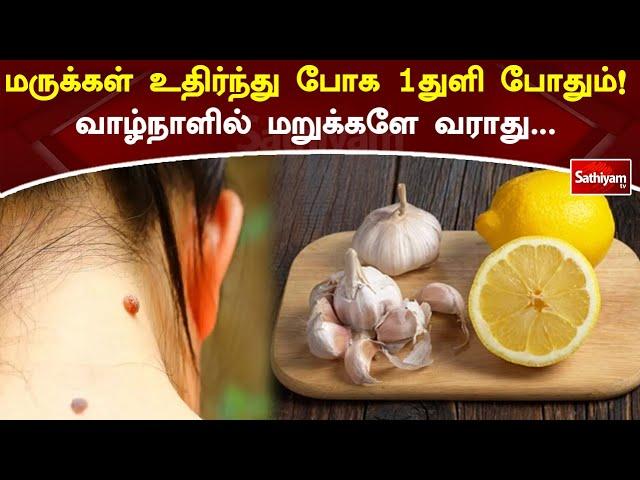 மருக்கள் உதிர்ந்து போக 1துளி  போதும்!!!வாழ்நாளில் மறுக்களே வராது | Web Special | SathiyamTV