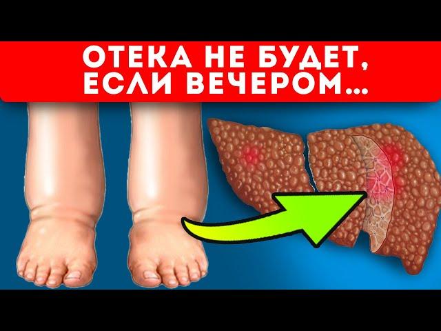 Ноги будут отекать КАЖДЫЙ день, Если не избавиться от этих…