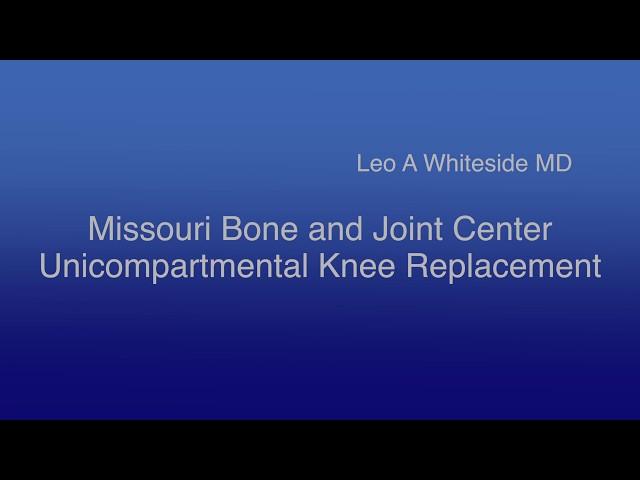 Missouri Bone and Joint Center unicompartmental knee replacement Leo Whiteside