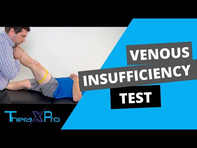 Brodie–Trendelenburg Test | Venous Insufficiency