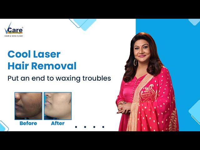 Cool Diode Laser Hair: Your Ultimate Hirsutism Treatment