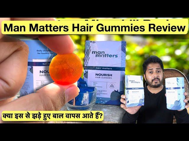 Man Matters Hair Gummies Review for Hair Growth.