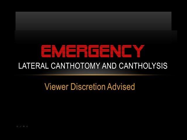 Emergency Lateral Canthotomy and Cantholysis