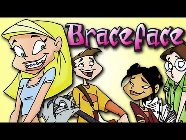 WAIT... Remember Braceface?