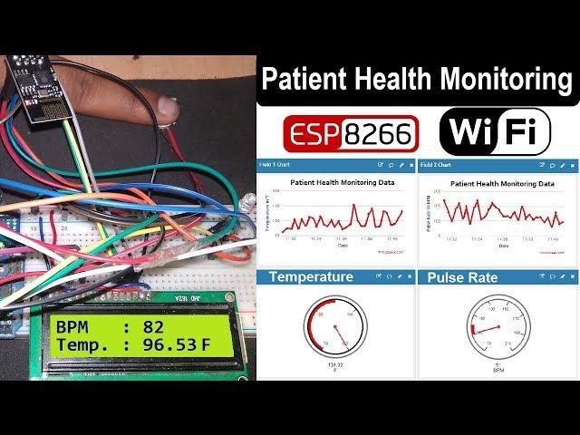 IoT Based Patient Health Monitoring System using ESP8266 & Arduino